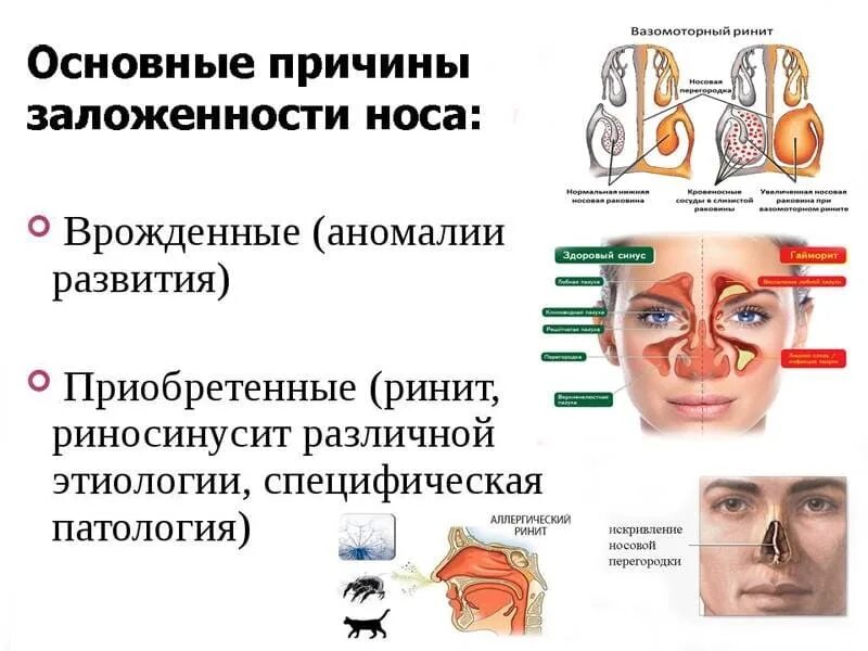 Постоянная заложенность носа у взрослого