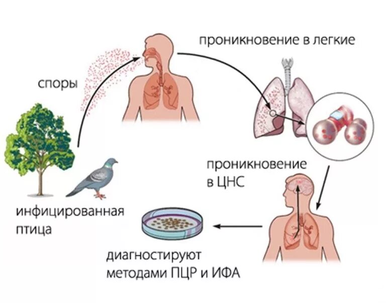 Орнитоз у человека лечение. Хламидиоз (орнитоз/пситтакоз птиц). Орнитоз патогенез схема. Орнитоз схема заражения.