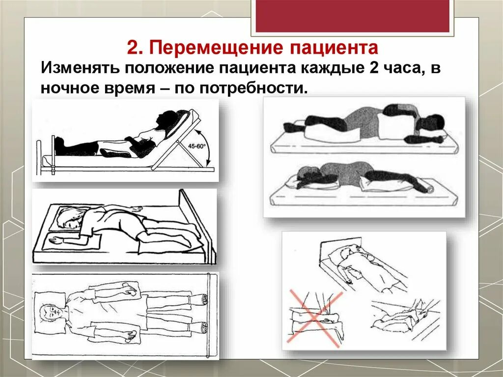 Передвижение пациента. Перемещение пациента. Движение пациентов. Перемещение пациента с помощью простыни. Объем движений пациента.