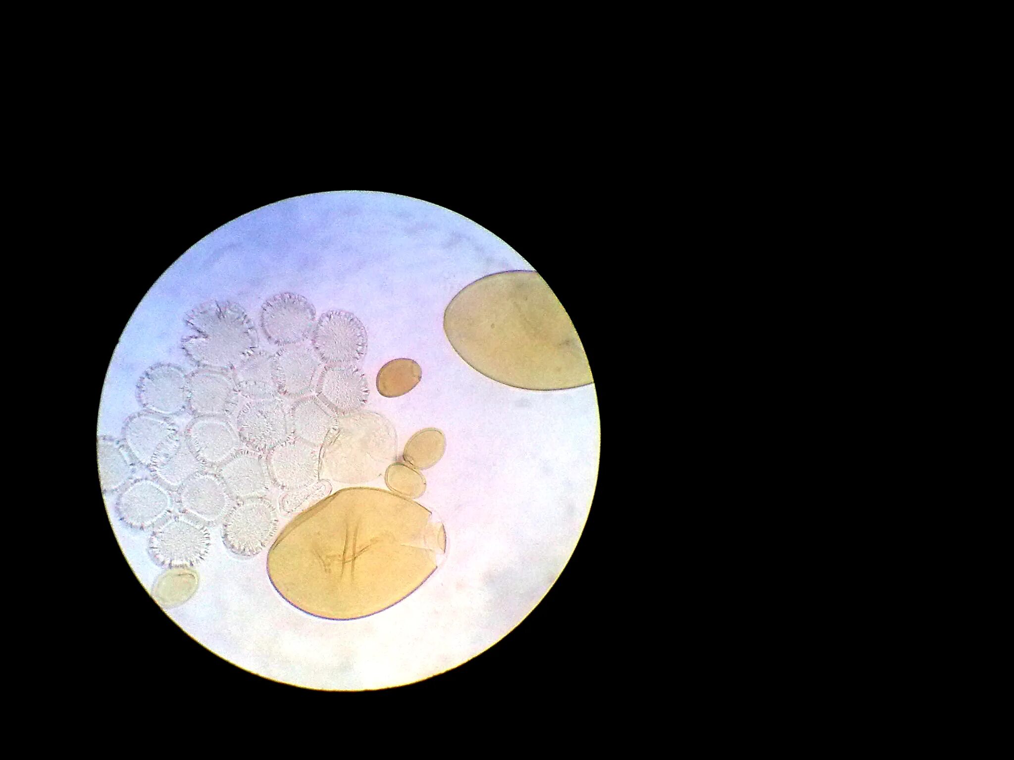 Эхинококк мультилокуларис. Яйца альвеококка под микроскопом. Яйцо с онкосферой