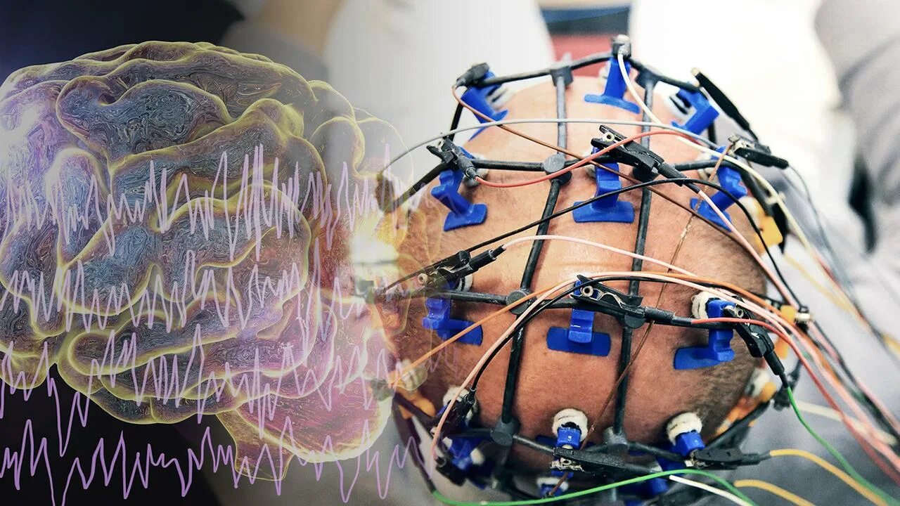 Доктор ээг. Метод картирования ЭЭГ. Электрическая активность мозга. Изучение мозга. ЭЭГ шапочка с электродами.