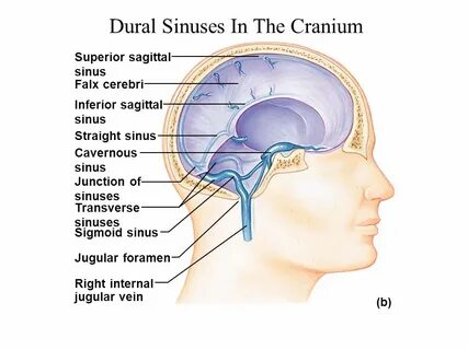 Sinus