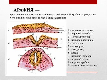 Нервный дефект