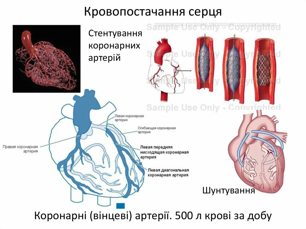 Расширяет коронарные сосуды. Стенд коронарных артерий. Стент для коронарных артерий. Стен коронарной артерии.