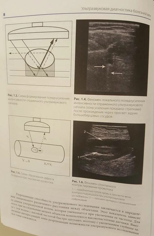 Чуриков Кириенко ультразвуковая диагностика болезней вен. Учебник по УЗИ диагностике. Ультразвуковая диагностика книги
