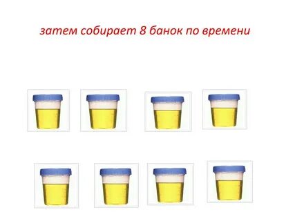 Сбор по зимницкому