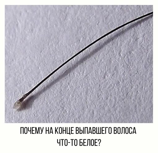 Волос выпал с луковицей - найдено 90 картинок