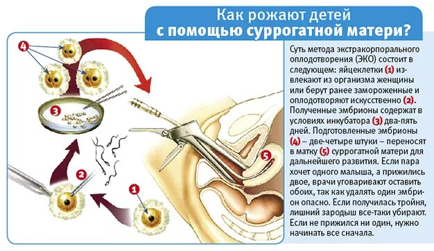 Как происходит суррогатное материнство. Суррогатное материнство схема. Суррогатное материнство как происходит оплодотворение. Схема экстракорпорального оплодотворения. Сколько стоит суррогатное материнство 2024