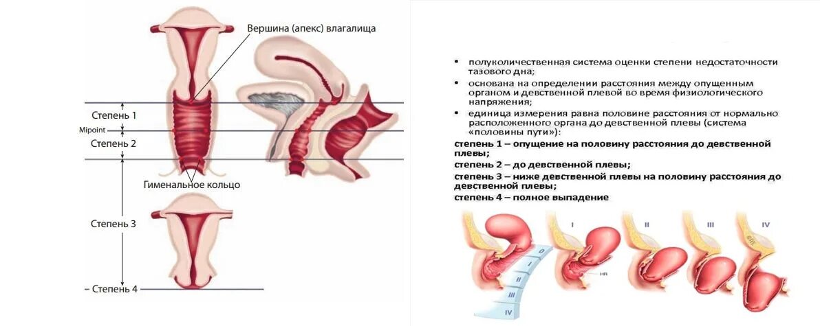 Почему Из Влагалища При Сексе Звук