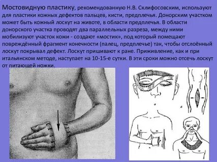Ласкут