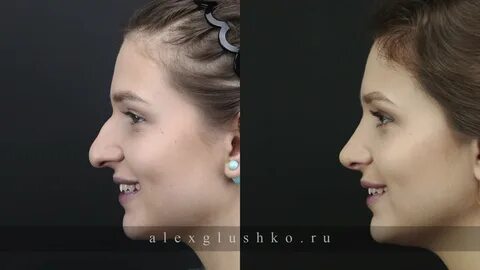 Пластика иваново
