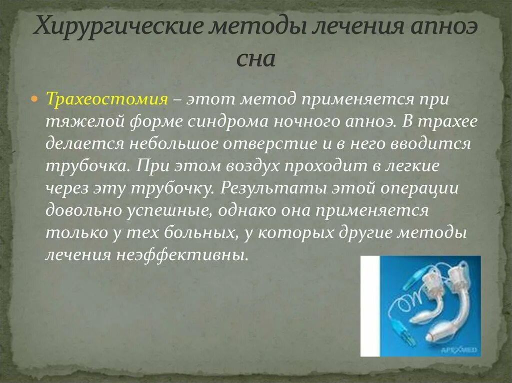 Апноэ что это такое у взрослых. Лекарство при апноэ сна. апноэ во сне у взрослых лечение. лечение апноэ у взрослых препараты. синдром апноэ во сне.