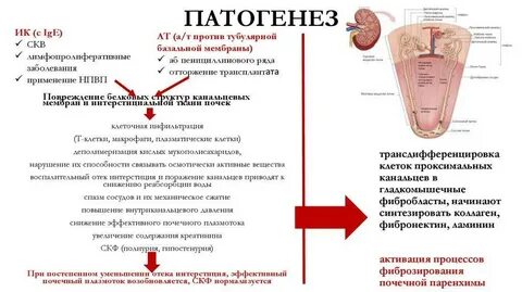 Этиология нефрит