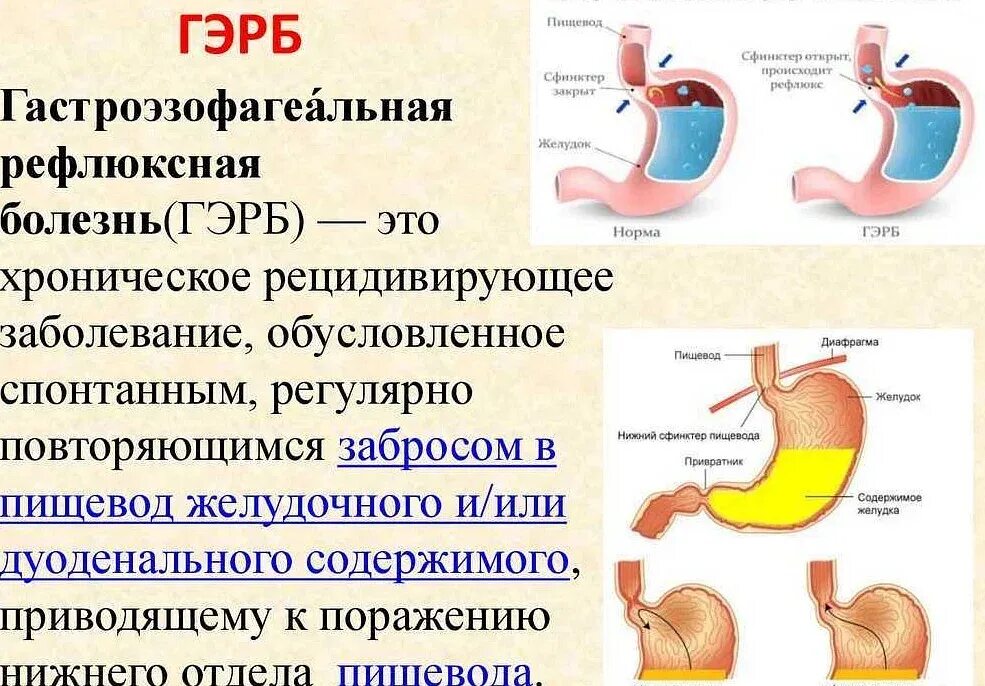 Почему идет постоянная отрыжка из желудка