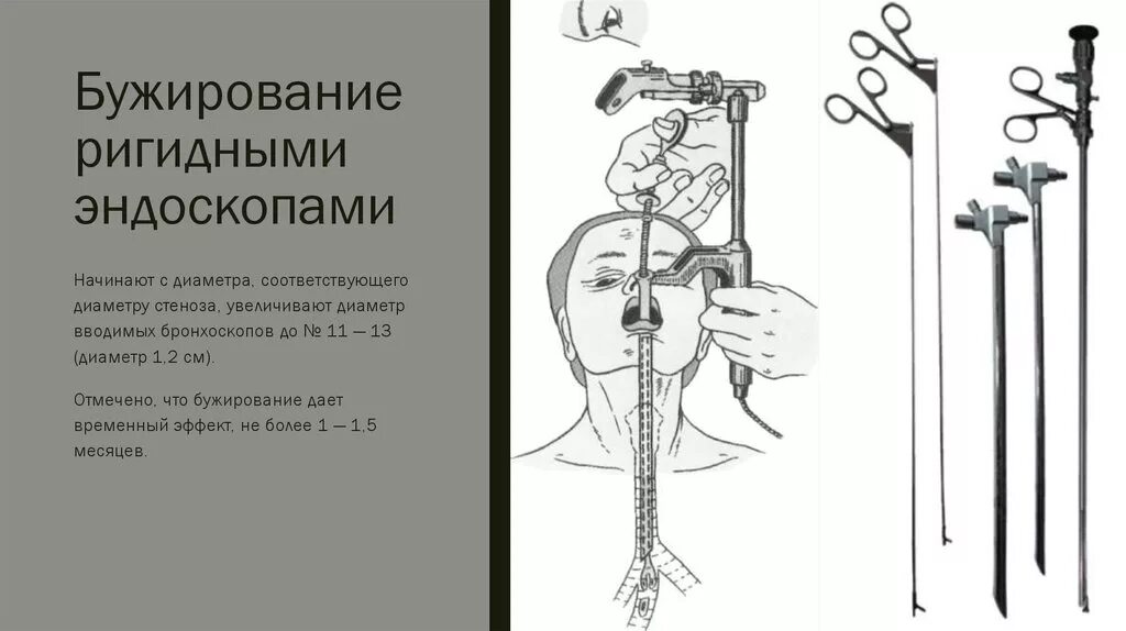 Стенд пищевода. Бужирование пищевода инструмент. Бужирование гортани процедура. Бужирование уретры инструменты.