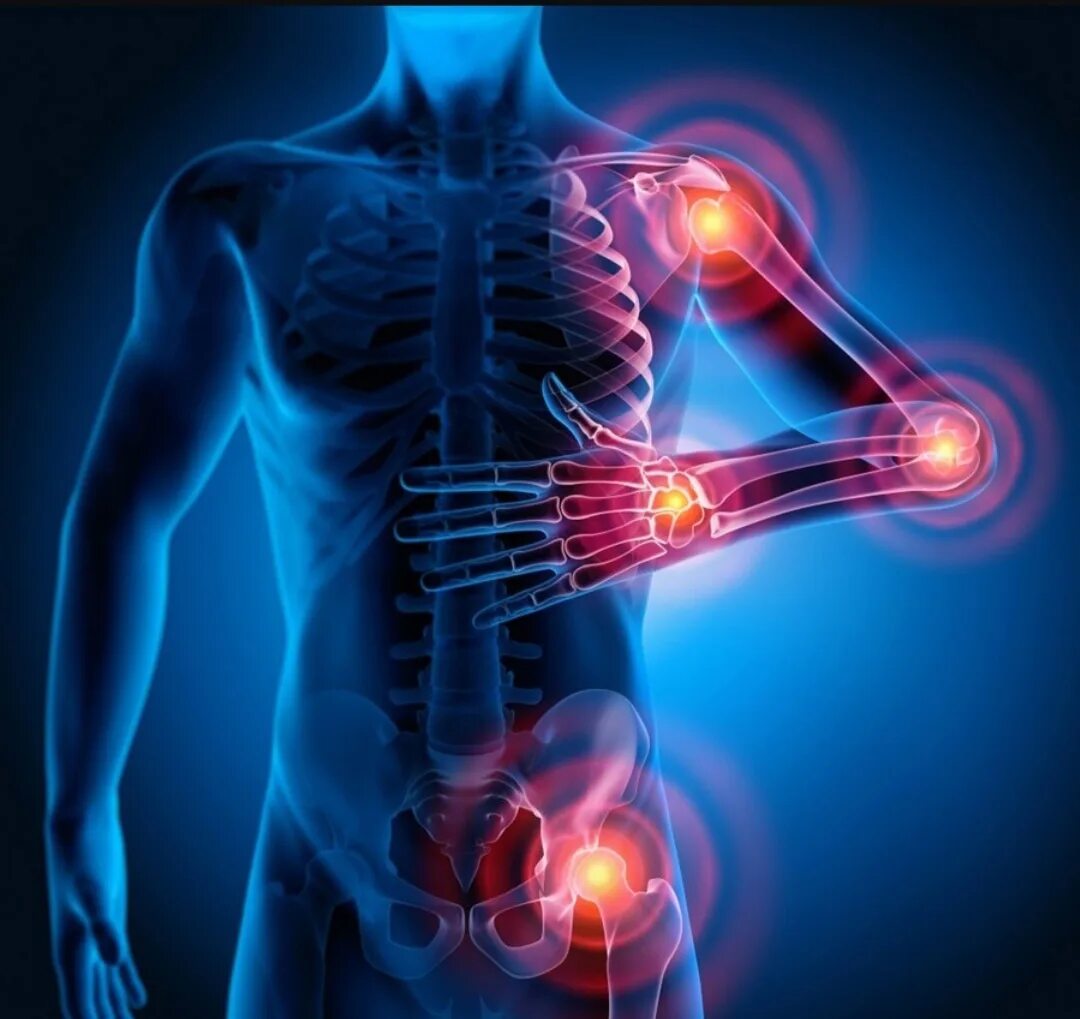 Болезненная тема. Суставы. Суставы картинки. Боль в суставах. Опорно двигательный аппарат.