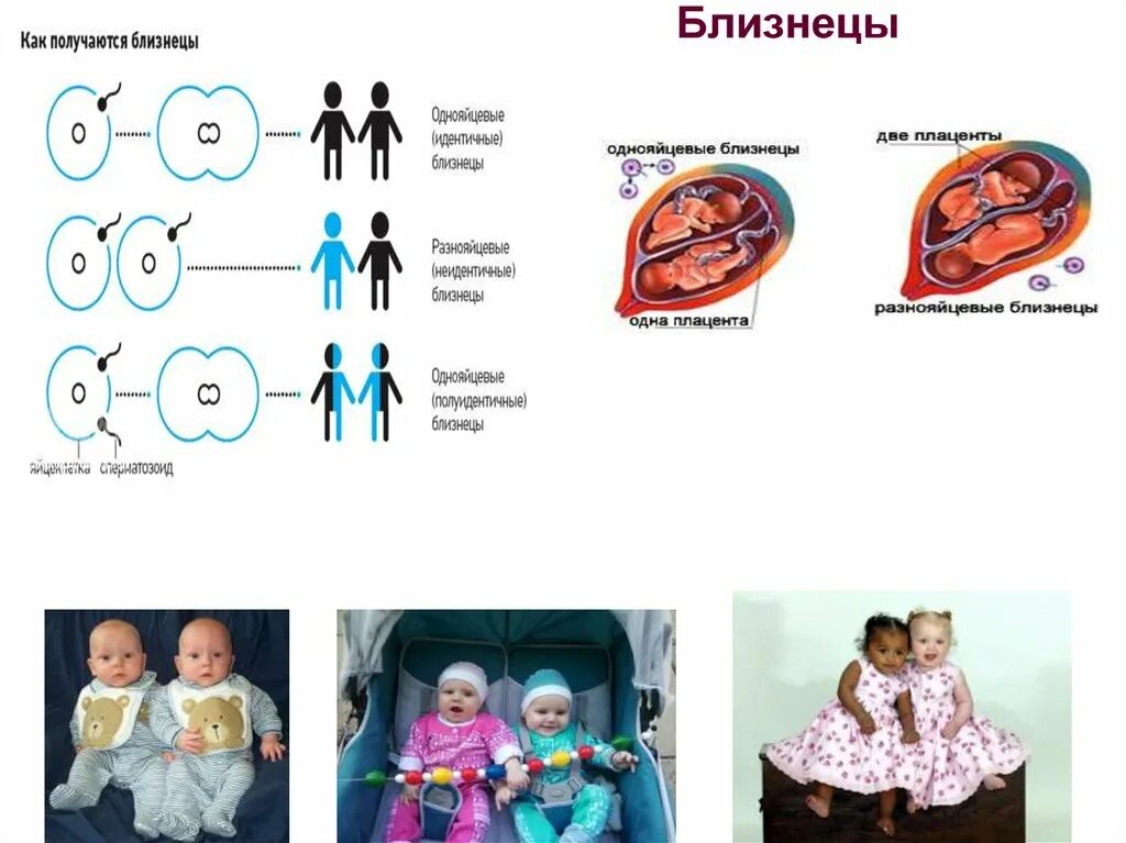 Как получаются близнецы и двойняшки. Как получаются однояйцевые близнецы. как получаяца близнецы. как получаются близнецы. как получаются двойняшк.