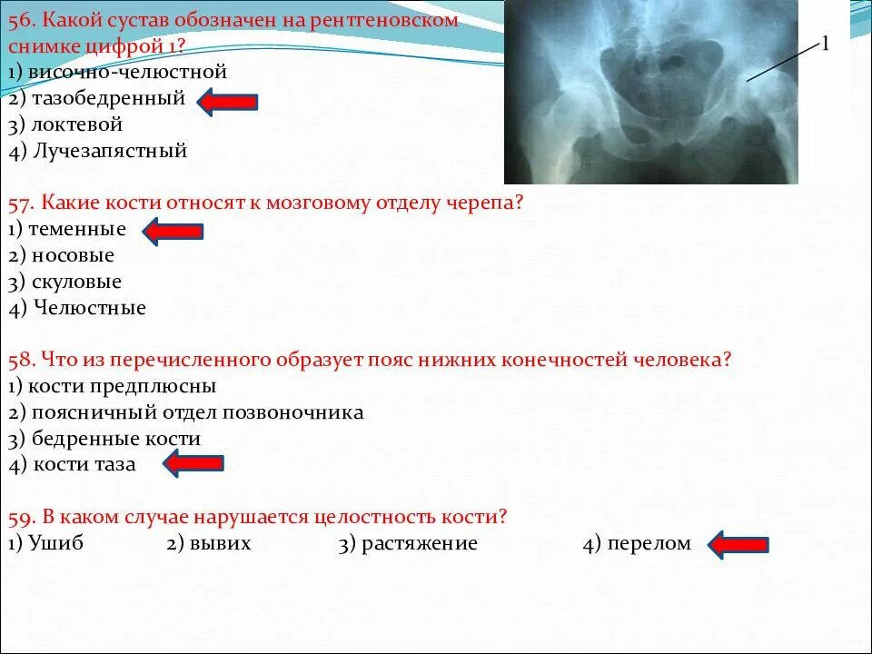 Какой сустав изображен. Какой сустав обозначен на рентгеновском снимке цифрой 1. Обозначения на рентгеновском снимке. Какой сустав обозначен на рентгеновском снимке цифрой. Какой сустав человека изображён на рентгеновском снимке.