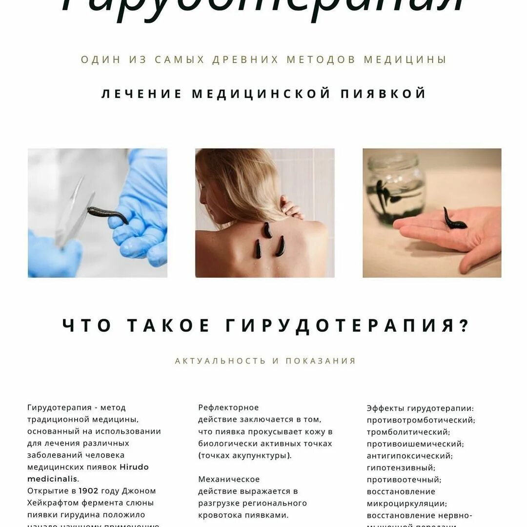 Курсы гирудотерапии. Хиджама гирудотерапия. хияма гирудотерапия. памятка брошюра пациенту при подготовке к сеансу гирудотерапии.