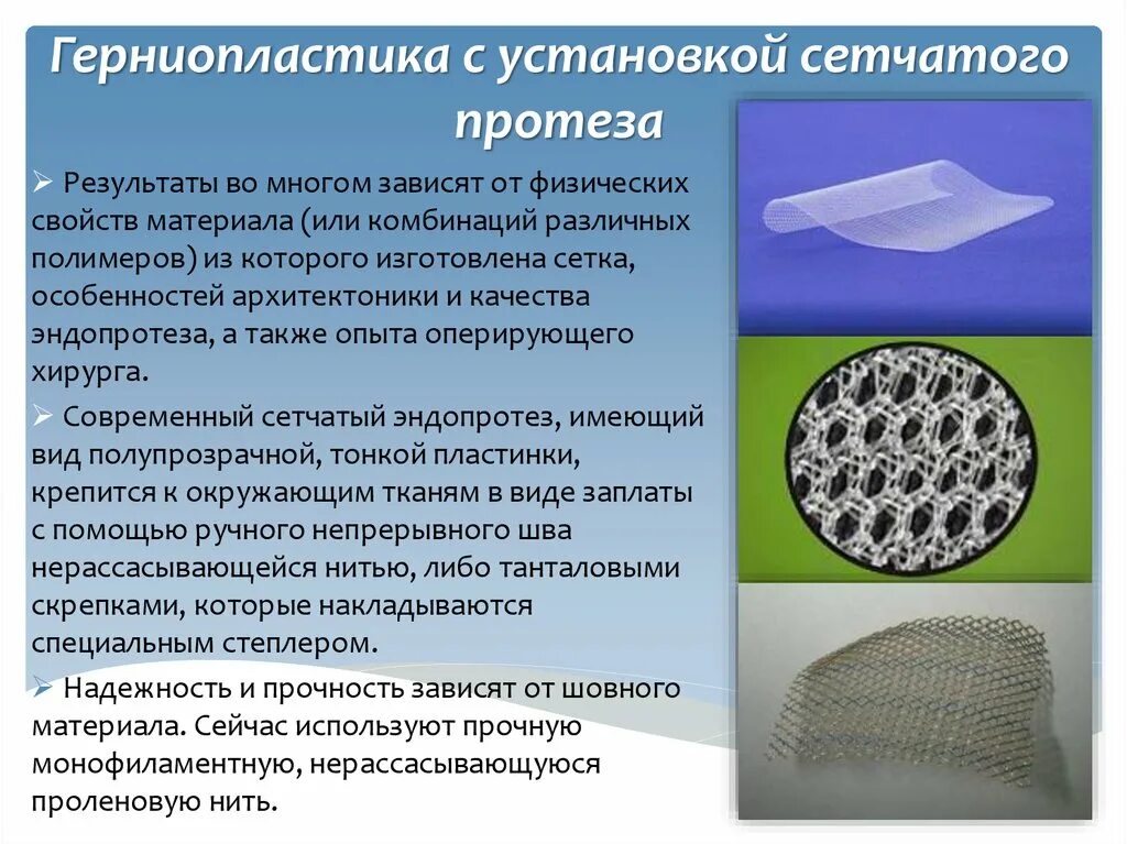 Сетка для герниопластики. Полипропиленовая сетка для герниопластики. Сетчатый протез герниопластика.