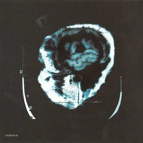 Breaking benjamin dear. Breaking benjamin dear agony. breaking benjamin - saturate (2002). breaking benjamin - dear agony (2009). breaking benjamin dear agony album cover.