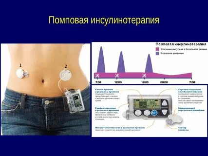 Инсулиновую кому