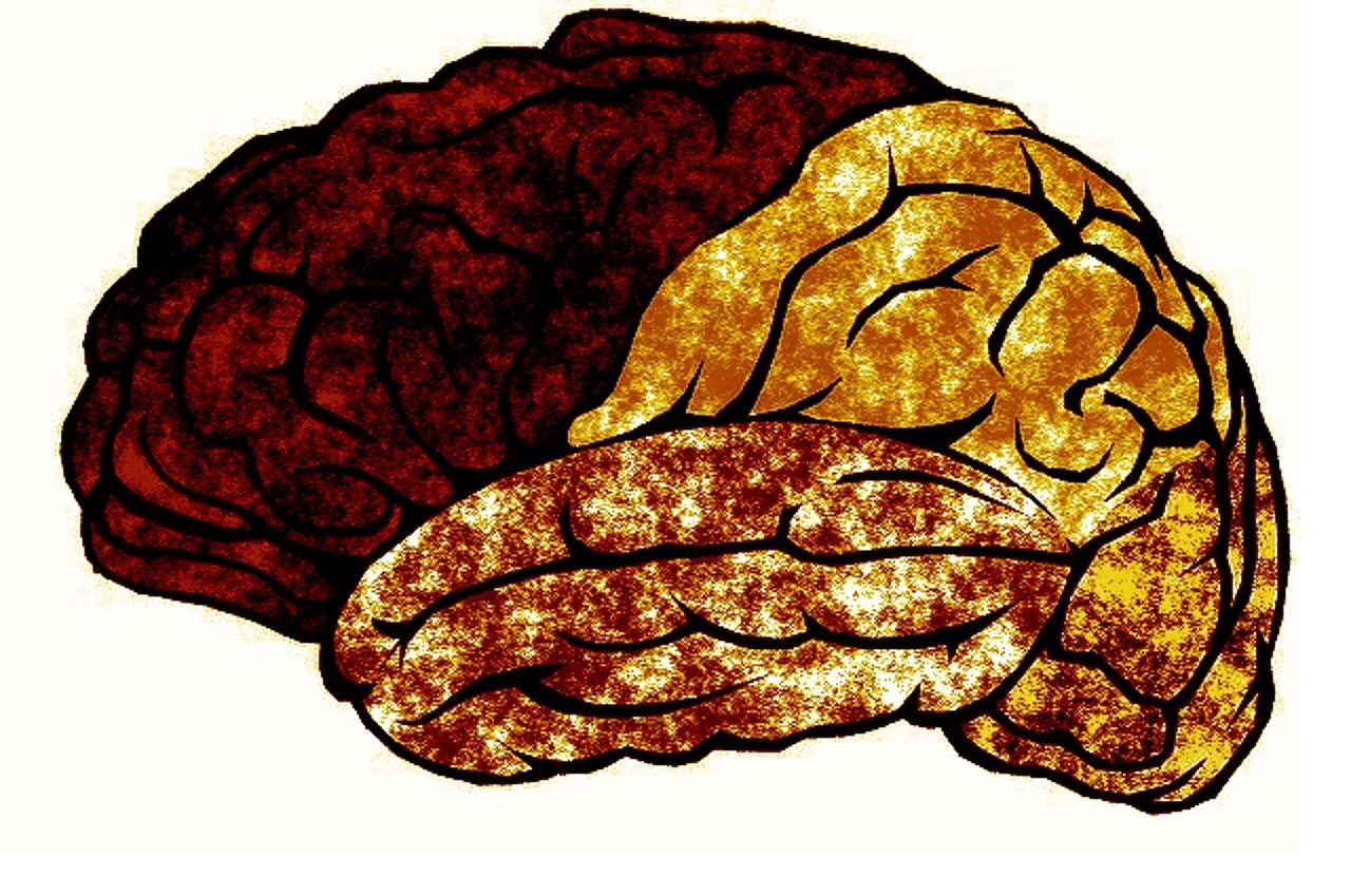 Brain rot. Картинки мозга человека прикольные.