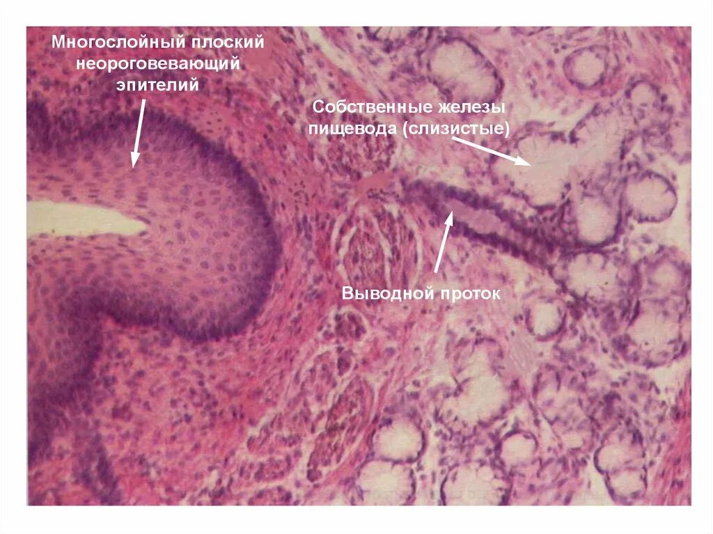Какие железы в пищеводе. Плоский эпителий гистология. Неороговевающий эпителий пищевода гистология. Многослойный плоский неороговевающий эпителий пищевода. Многослойный плоский неороговевающий эпителий пищевода препарат.