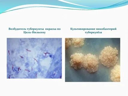 Форма микобактерии туберкулеза