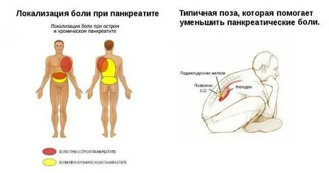 Острая боль поджелудочной как снять