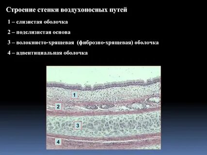 Клетки воздухоносных путей