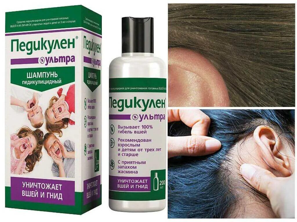 Средство от вшей. Эффективное средство от вшей. Паранит спрей фл. Какое лучшее средство от вшей. 100 мл.