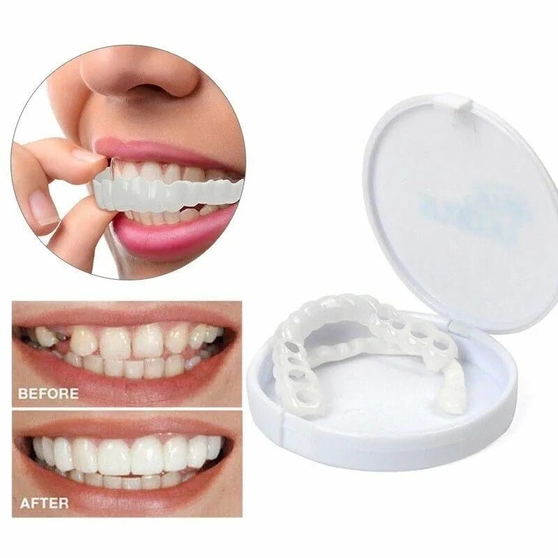 Виниры для зубов Perfect Smile Veneer от 60 руб. в Москве. opt2008.ru