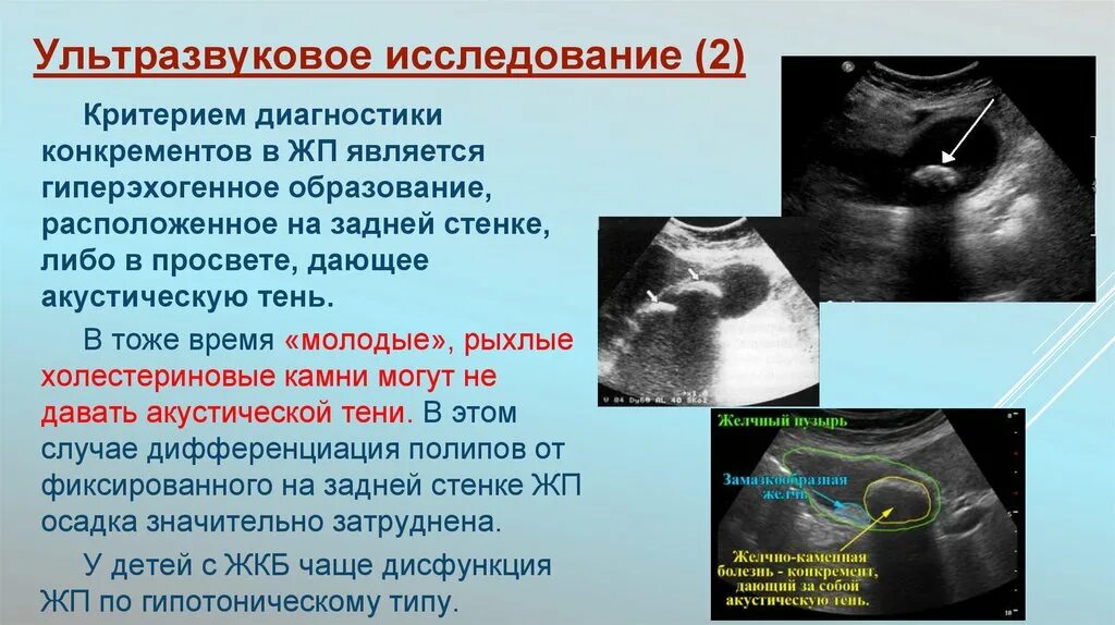 Желчный пузырь гомогенное что значит. Конкременты желчного пузыря УЗИ. Гиперэхогенное образование на УЗИ. Образование желчного пузыря на УЗИ. УЗИ желчного пузыря гиперэхогенные.