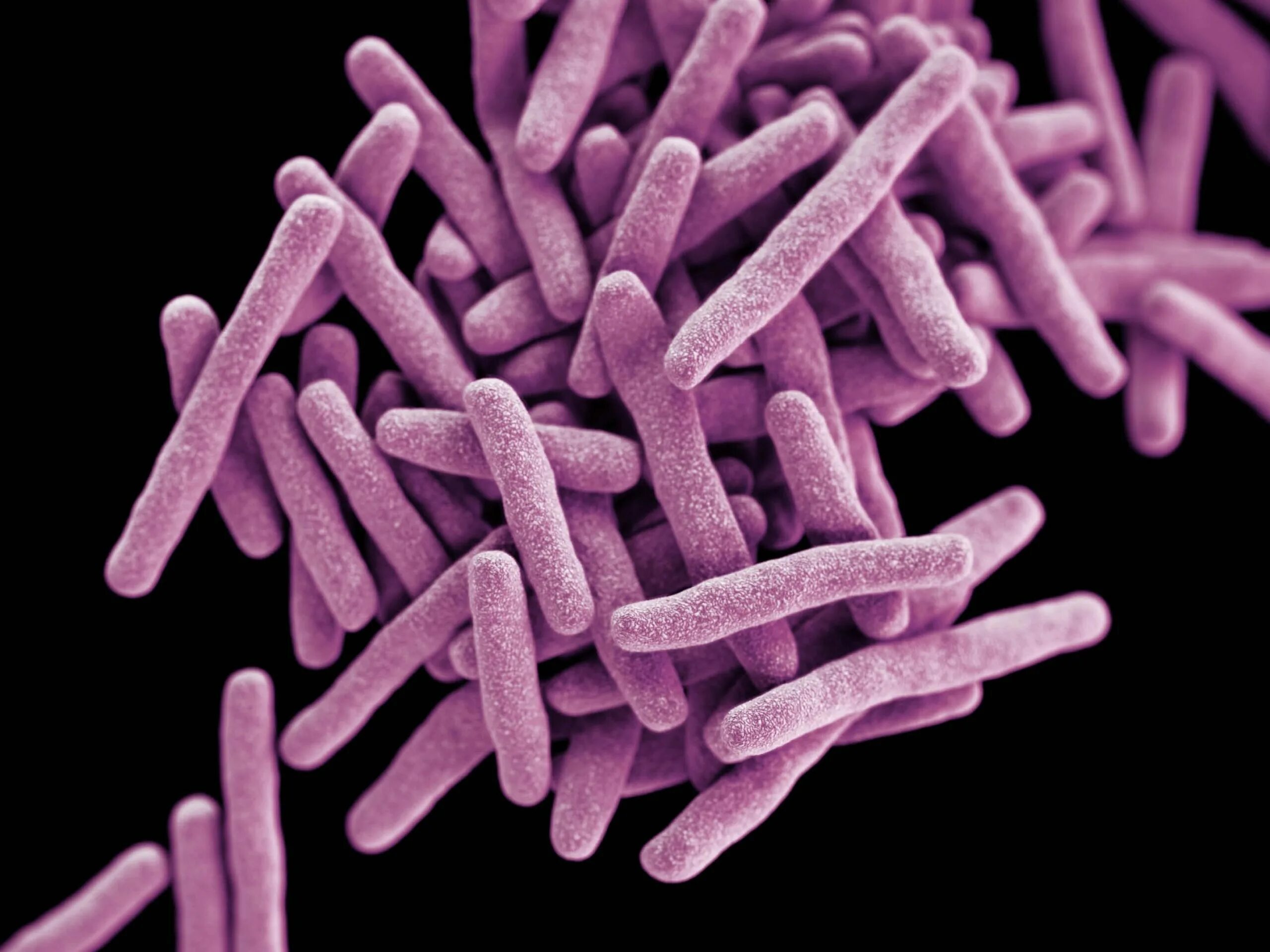 Бактерия Mycobacterium tuberculosis. Палочка Коха Mycobacterium tuberculosis. Бактерии рода Mycobacterium. Паратуберкулез возбудитель.