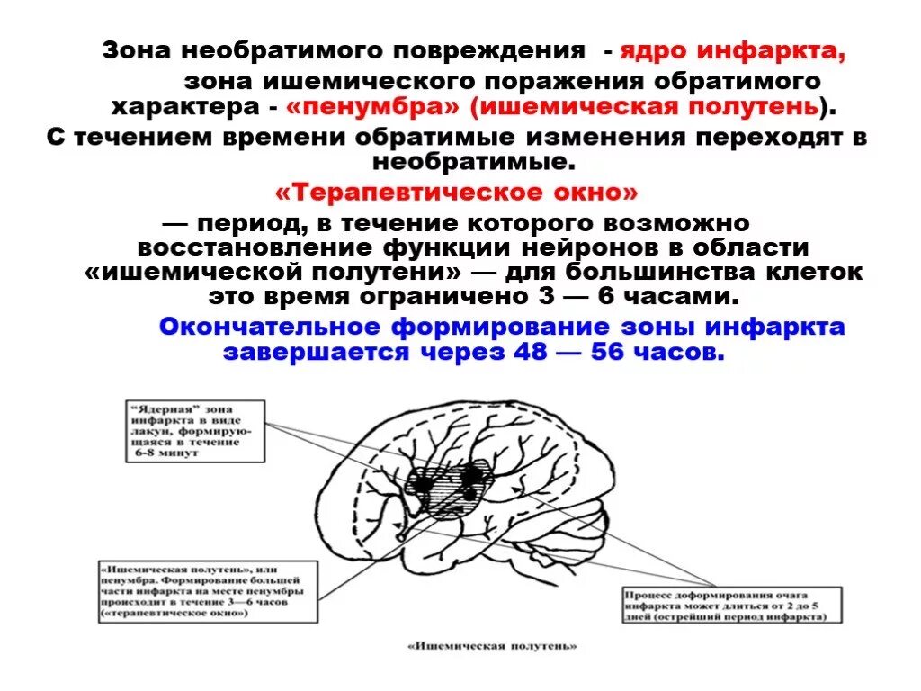 Зона инсульта