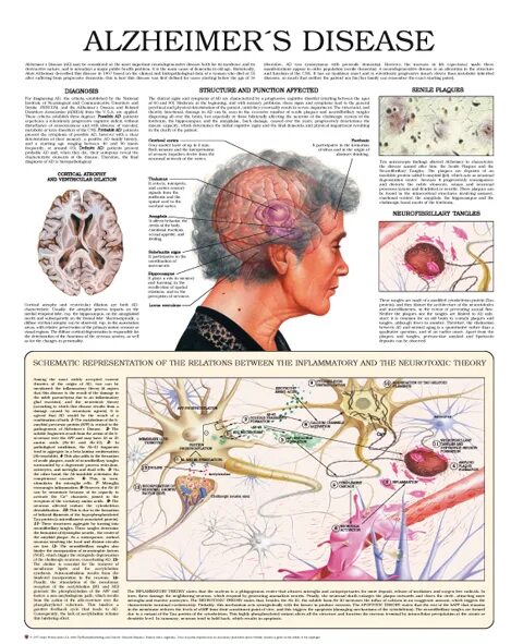 Альцгеймера книга. Мы - это наш мозг. Деменция плакат. Нестареющий мозг дейл бредесен. От матки до альцгеймера книга.