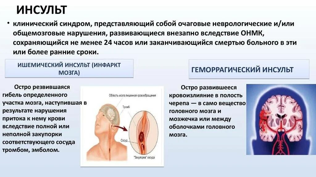 Инсульт паралич левой. Синдромы ОНМК ишемический инсульт. Инсульт неврология. Инсульт неврология лекция. Клинические проявления ишемического инсульта.