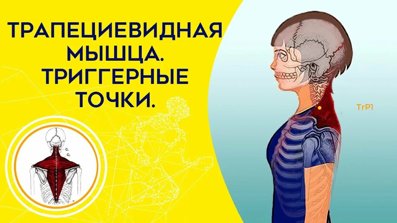 Клэр дэвис точки. Триггерные точки девис. клэр дэвис триггерные. триггерные точки на шее. триггерные точки клэр дэвис.