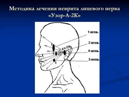 Физиотерапия нерв