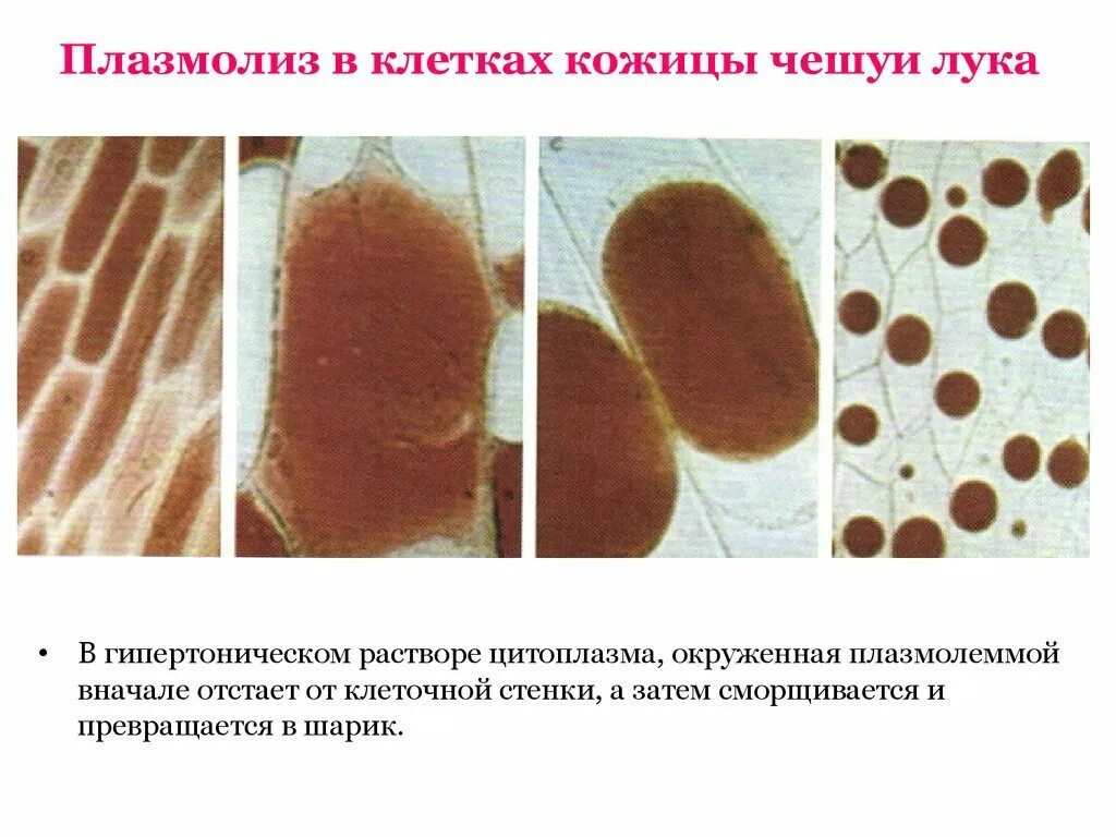 Лук плазмолиз. Плазмолиз растительной клетки. Тургор плазмолиз деплазмолиз. Плазмолиз и деплазмолиз. Уголковый плазмолиз.