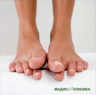 Почему сводит пальцы ног что делать