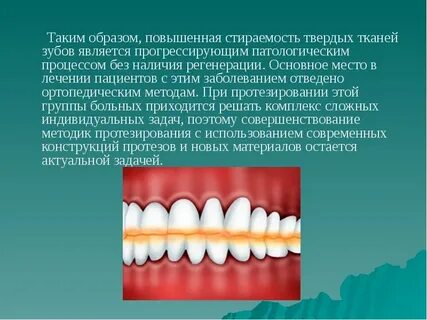 Бруксизм в стоматологии