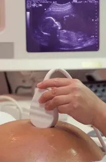 Сколько раз делают узи