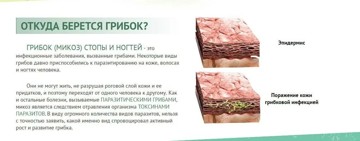 Названия кожных заболеваниях у взрослых. Грибковые заболевания кожи, микозы кожных складок. классификация грибковых поражений кожи.