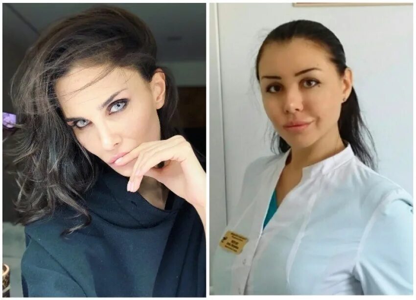 Мамаева до и после пластики фото