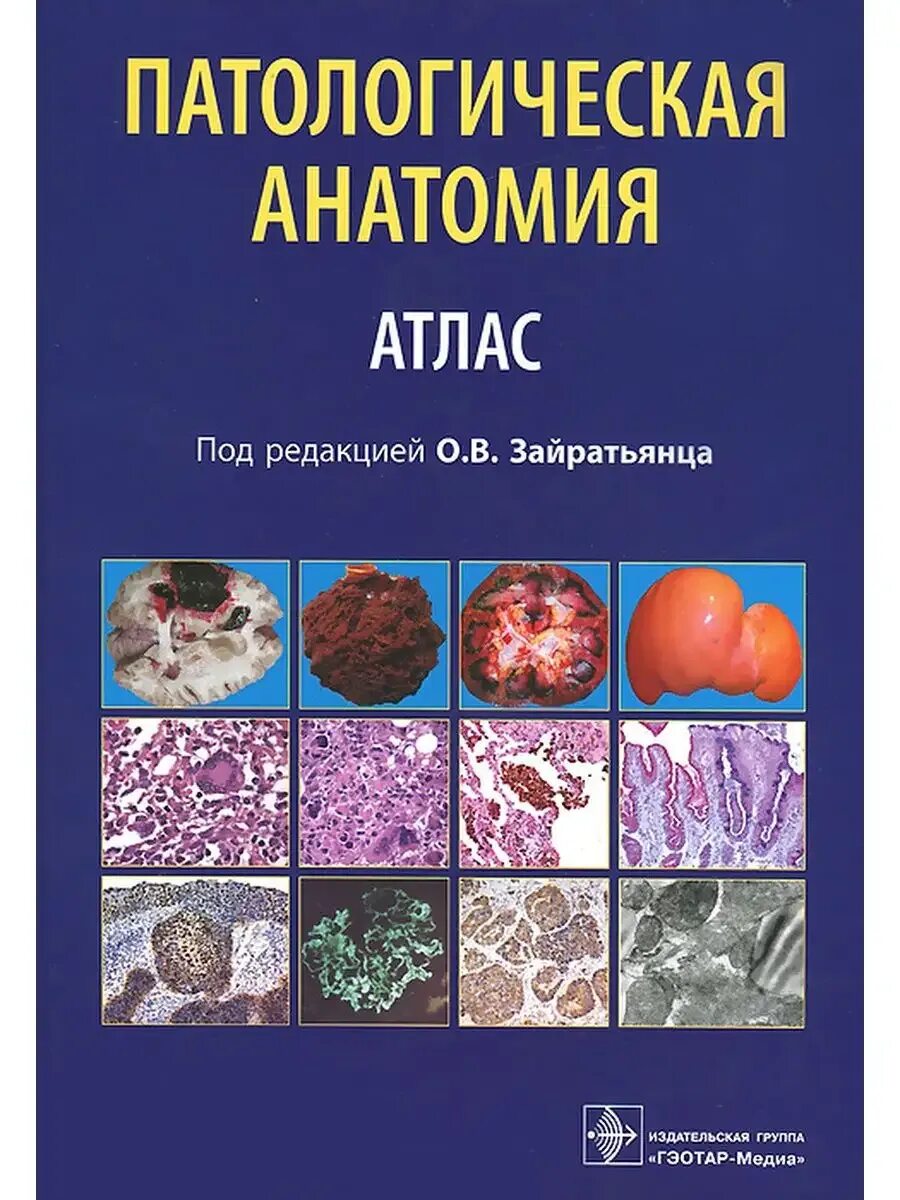 Атлас офтальмологии. Луговская атласы. Кански атлас по офтальмологии. Лабораторная гематология луговская. Гематология книга.