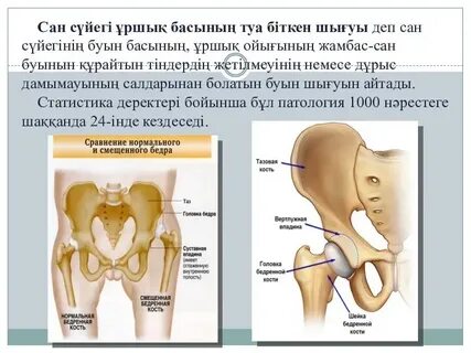 ит стиліндегі жалаңаш қыздар