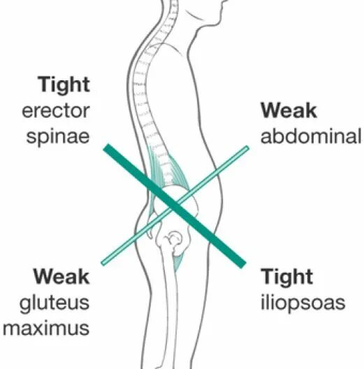 Hips system. Hips system. Апоневроз бедра. Hips system. Таз человека.