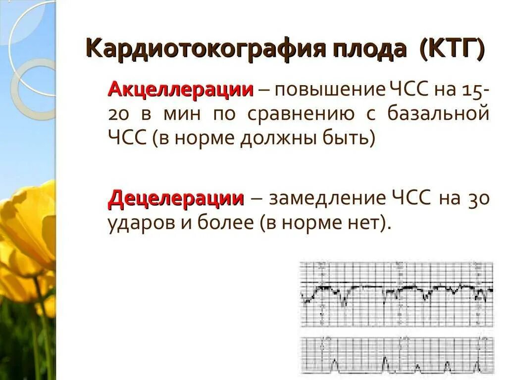 Исследование сердцебиения плода. Оценка КТГ исследования. Оценка состояния плода по данным КТГ. Кардиотокография плода методика проведения.